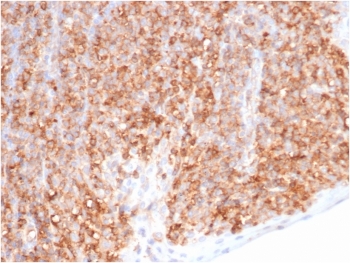 IHC staining of FFPE human tonsil tissue with HLA-G antibody (clone HLAG/6686) at 2ug/ml. HIER: boil tissue sections in pH 9 10mM Tris with 1mM EDTA for 20 min and allow to cool before testing.