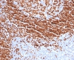 IHC staining of FFPE human tonsil tissue with SOX11 antibody (clone SOX11/7236). HIER: boil tissue sections in pH 9 10mM Tris with 1mM EDTA for 20 min and allow to cool before testing.