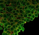 Immunofluorescent staining of PFA-fixed human HeLa cells using SP100 antibody (green, clone PCRP-SP100-1B9) and phalloidin (red).