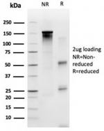 SDS-PAGE analysis of purified, BSA-free SP100 antibody (PCRP-SP100-1B9) as confirmation of integrity and purity.