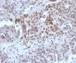 IHC staining of FFPE human colon tissue with SP100 antibody (clone PCRP-SP100-1B9) at 2ug/ml in PBS for 30min RT. HIER: boil tissue sections in pH 9 10mM Tris with 1mM EDTA for 20 min and allow to cool before testing.