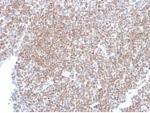 IHC staining of FFPE human tonsil tissue with SP100 antibody (clone PCRP-SP100-1B9) at 2ug/ml in PBS for 30min RT. HIER: boil tissue sections in pH 9 10mM Tris with 1mM EDTA for 20 min and allow to cool before testing.