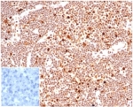 IHC staining of FFPE human lymph node tissue with PCNA antibody (clone PCNA/6580) at 2ug/ml. Negative control inset: PBS instead of primary antibody to control for secondary binding. HIER: boil tissue sections in pH 9 10mM Tris with 1mM EDTA for 20 min and allow to cool before testing.