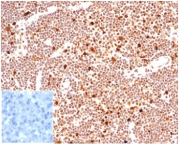 IHC staining of FFPE human lymph node tissue with PCNA antibody (clone PCNA/6580) at 2ug/ml. Negative control inset: PBS instead of primary antibody to control for secondary binding. HIER: boil tissue sections in pH 9 10mM Tris with 1mM EDTA for 20 min and allow to cool before testing.