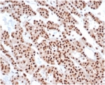 IHC staining of FFPE human tonsil tissue with PCNA antibody (clone PCNA/6580) at 2ug/ml. HIER: boil tissue sections in pH 9 10mM Tris with 1mM EDTA for 20 min and allow to cool before testing.