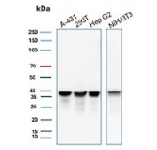 Western blot testing of human A431, 293T and HepG2 cell lysate and mouse NIH 3T3 cell lysate with PCNA antibody. Predicted molecular weight ~29 kDa, routinely observed at 29~36 kDa.