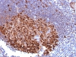 IHC staining of FFPE human Lymph Node tissue with PU.1 antibody (clone PU1/2118). HIER: boil tissue sections in pH 9 10mM Tris with 1mM EDTA for 20 min and allow to cool before testing.