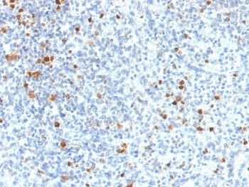 IHC staining of FFPE human spleen tissue with PU.1 antibody (clone PU1/2118). HIER: boil tissue sections in pH 9 10mM Tris with 1mM EDTA for 20 min and allow to cool before testing.