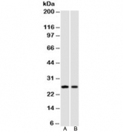 Western blot testing of human A) HeLa and B) Jurkat cell lysate using p27Kip1 antibody (clone SPM348).