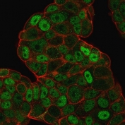Immunofluorescent staining of PFA fixed human MCF7 cells with p27Kip1 antibody (clone SPM348, green) and Phalloidin (red).