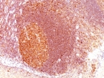 IHC: Formalin-fixed, paraffin-embedded human tonsil stained with MALT1 antibody (clone SPM578).