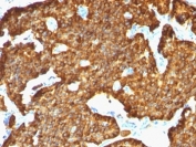 IHC: Formalin-fixed, paraffin-embedded human pancreas stained with Chromogranin A antibody (SPM553).