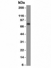 Western blot of human human stomach lysate using CEA antibody (SPM584). Expected molecular weight: 80~200 kDa depending on glycosylation level.