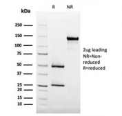 SDS-PAGE analysis of purified, BSA-free CD35 antibody (clone SPM554) as confirmation of integrity and purity.