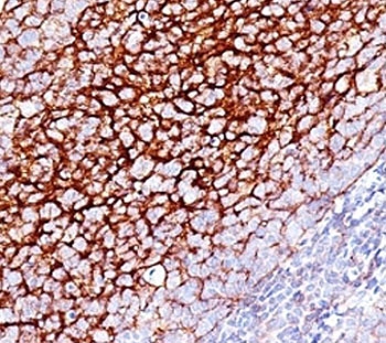 IHC: Formalin-fixed, paraffin-embedded human tonsil stained with CD35 antibody (SPM554).~