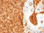 IHC: Formalin-fixed, paraffin-embedded human fetal liver stained with AFP antibody (SPM334).