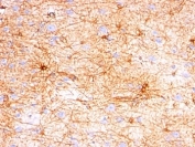 IHC: Formalin-fixed, paraffin-embedded human cerebellum stained with GFAP antibody (SPM507).