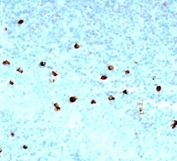 IHC: Formalin-fixed, paraffin-embedded human tonsil stained with IgM antibody (SPM557).