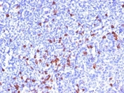 IHC: Formalin-fixed, paraffin-embedded human tonsil stained with Kappa Light Chain antibody (clone SPM508).