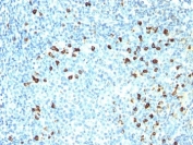 IHC: Formalin-fixed, paraffin-embedded human tonsil stained with anti-Kappa antibody (clone SPM558).