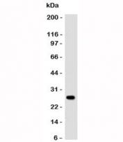 Western blot of human intestinal lysate using anti-Lambda antibody (clone SPM559).