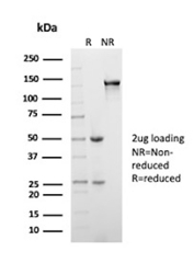 SDS-PAGE analysis of purified, BSA-free recombinant PSA/Prostate Specific Antigen antibody (clone SPM352) as confirmation of integrity and purity.