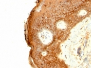 IHC: Formalin-fixed, paraffin-embedded human skin stained with Involucrin antibody (SPM259)