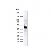 Western blot testing of human HCT-116 cell lysate with Cytokeratin 8 antibody (clone SPM192).