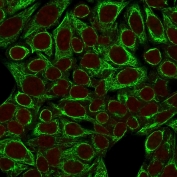 Immunofluorescent staining of fixed human HeLa cells with Cytokeratin 8 antibody (clone SPM192, green) and Reddot nuclear stain (red).