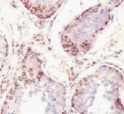 IHC: Formalin-fixed, paraffin-embedded human testis stained with MAGE-1 antibody (SPM282).