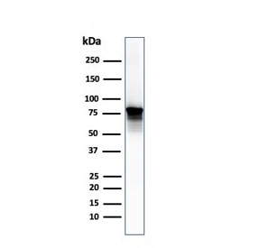 Western blot testing of human PC3 lysate with Moesin antibody (clone SPM562). Predicted molecular weight ~68 kDa but routinely observed at 68-78 kDa.