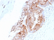 IHC: Formalin-fixed, paraffin-embedded human colon stained with Mucin-2 antibody (SPM513).