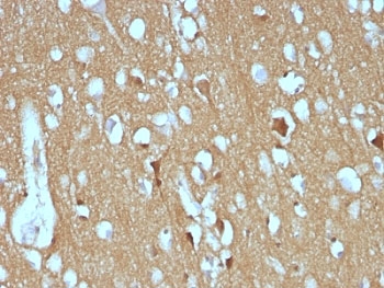 IHC: Formalin-fixed, paraffin-embedded human cerebellum stained with CD56 antibody (SPM128)~
