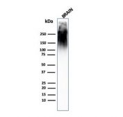 Western blot testing of human brain lysate with anti-Neurofilament antibody (clone SPM563).