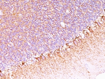 IHC: Formalin-fixed, paraffin-embedded human cerebellum stained with anti-Neurofilament antibody (SPM563).~