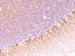 IHC: Formalin-fixed, paraffin-embedded human cerebellum stained with anti-Neurofilament antibody (SPM563).