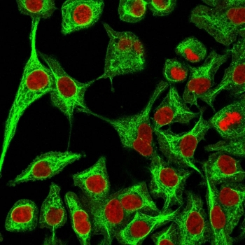 Immunofluorescent staining of fixed human A549 cells with anti-Cytokeratin 14 antibody (clone SPM263, green) and Reddot nuclear stain (red).
