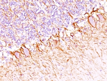 IHC: Formalin-fixed, paraffin-embedded human cerebellum stained with anti-NF-H antibody (SPM203).~
