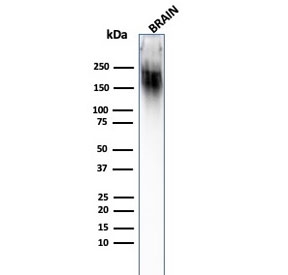 Western blot testing of human brain lysate with anti-NF-H antibody (clone SPM203).