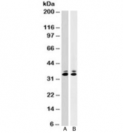 Western blot testing of A) human HeLa and B) mouse NIH3T3 cell lysates with anti-PCNA antibody (clone SPM350). Predicted molecular weight ~29 kDa, routinely observed at 29~36 kDa.