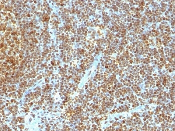 IHC analysis of formalin-fixed, paraffin-embedded human tonsil stained with anti-PCNA antibody (clone SPM350).~