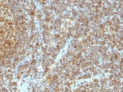 IHC analysis of formalin-fixed, paraffin-embedded human tonsil stained with anti-PCNA antibody (clone SPM350).