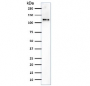 Western blot testing of human Jurkat cell lysate with CD31 antibody (clone SPM532). Expected molecular weight: 83-130 kDa depending on level of glycosylation.