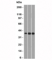 Western blot testing of 1) human HepG2, 2) mouse NIH3T3 and 3) mouse C2C12 lysate with CCND1 antibody (clone SPM587). Expected/observed molecular weight ~32-36kDa.
