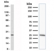 Western blot of testing of human skin lysate (left) and human MCF7 cell lysate (right) using anti-Bcl-2 antibody (clone SPM530).
