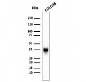 Western blot testing of human COLO-38 cell lysate with gp100 antibody (clone SPM142).