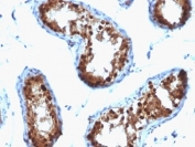 IHC: Formalin-fixed, paraffin-embedded human testicular carcinoma stained with SUMO-2/3 antibody (clone SPM572).