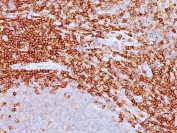 IHC: Formalin-fixed, paraffin-embedded human tonsil stained with CD43 antibody (clone SPM503).