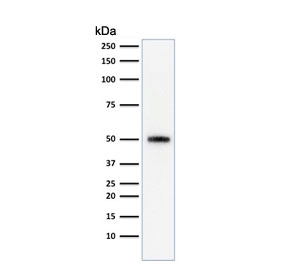 Western blot testing of human HeLa cell lysate with anti-p53 antibody (clone SPM590). Expetected molecular weight ~53 kDa.~