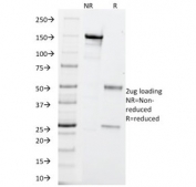 SDS-PAGE analysis of purified, BSA-free anti-UchL1 antibody (clone SPM575) as confirmation of integrity and purity.